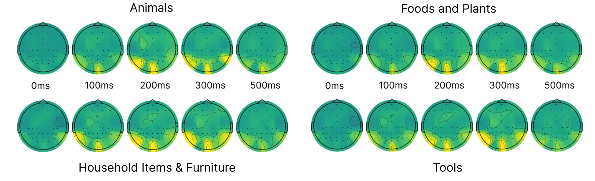 Saliency maps showing model attention across EEG channels and time, consistently highlighting occipital electrode locations around 200ms post-stimulus, confirming the model relies on true visual cortex activity rather than artifacts
